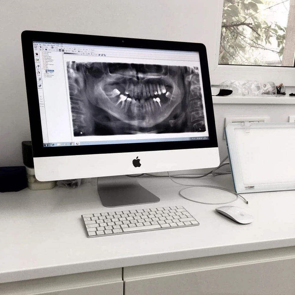 A panoramic radiograph on the clinic's monitor during a case review.