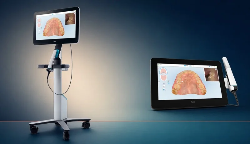 The iTero intraoral scanner.